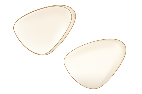 ラミネートべニア