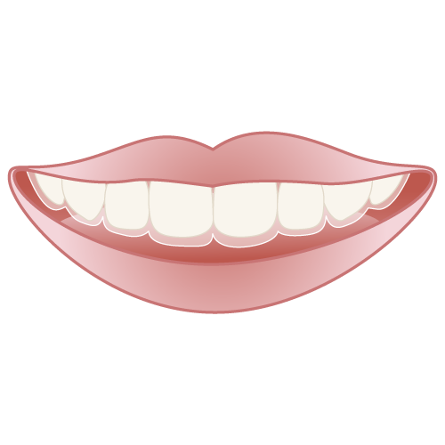 インビザライン